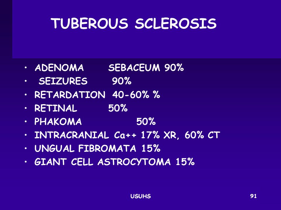 TUBEROUS SCLEROSIS ADENOMA SEBACEUM 90% SEIZURES 90%