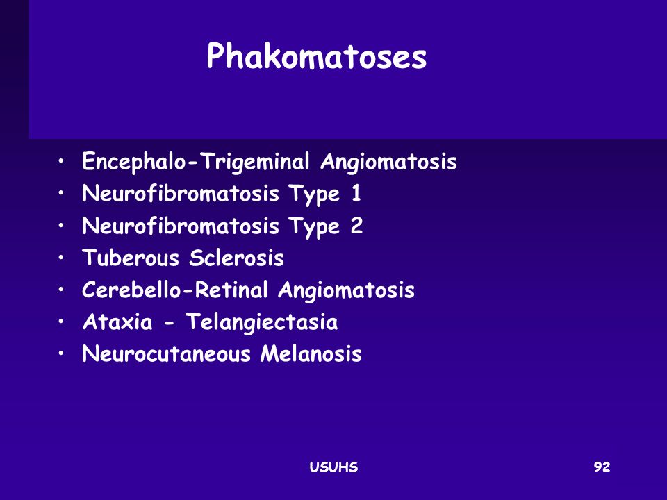 Phakomatoses Encephalo‑Trigeminal Angiomatosis