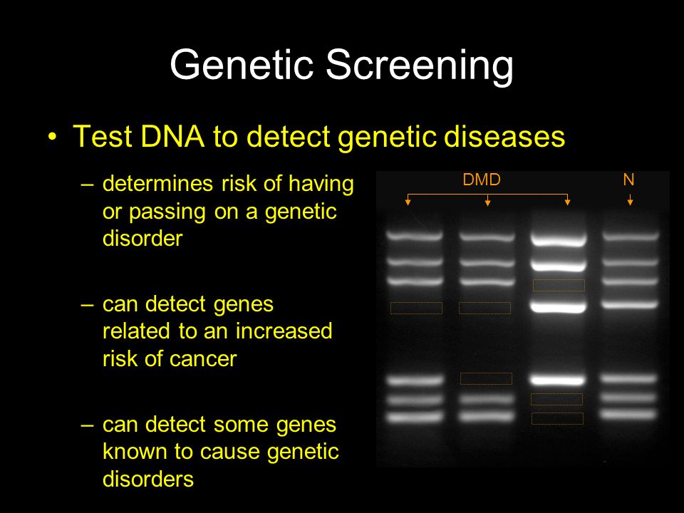 Genetic Screening Test DNA to detect genetic diseases
