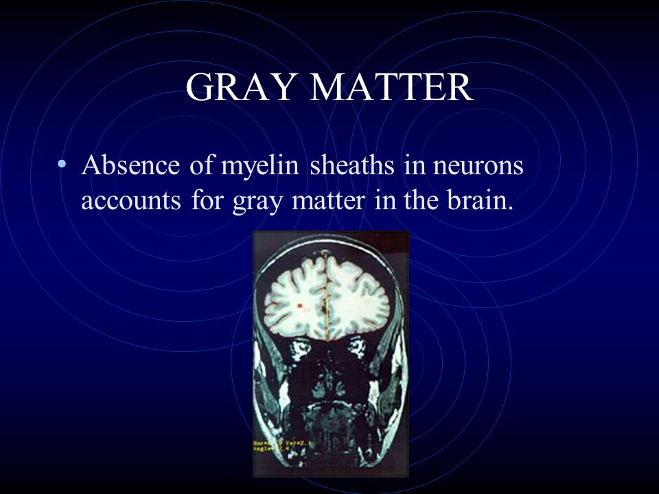 GRAY MATTER Absence of myelin sheaths in neurons accounts for gray matter in the brain.