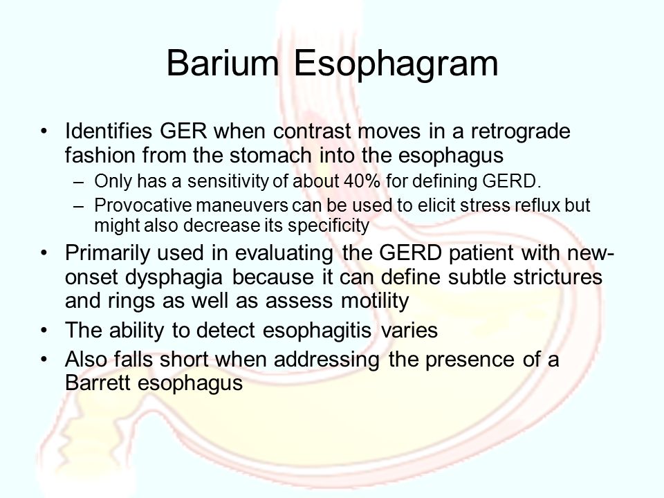 Gastroesophageal Reflux Disease: Diagnosis and Investigation