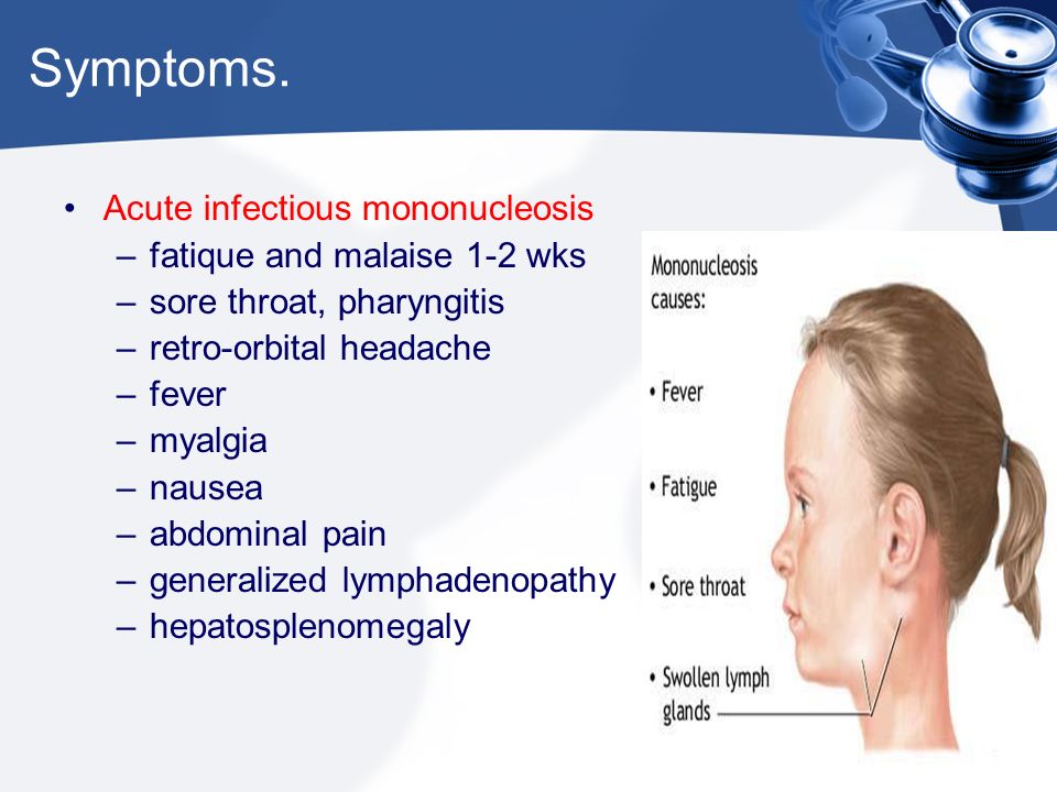 Infectious Mononucleosis Ppt Video Online Download