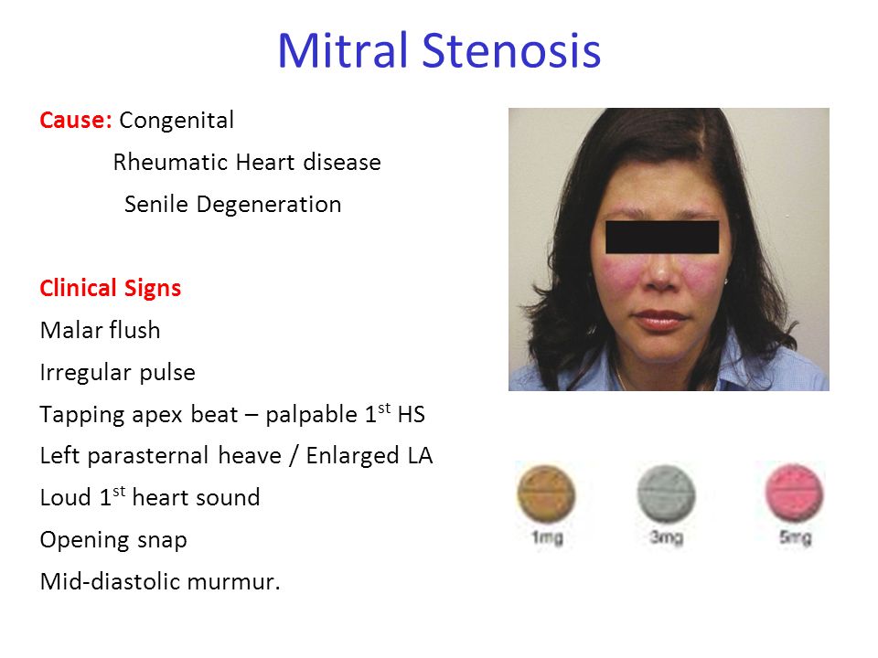 Cardiology For Finals Fy1s Poornima Mohan Ghazal Saadat Ppt