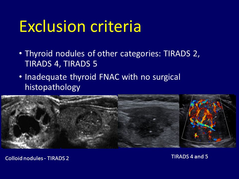 Ti rads 3 в щитовидной. Tirads4 щитовидной железы Tirads 4. Классификация щитовидной железы по Tirads. Тирадс УЗИ. Tirads 3 щитовидная железа.