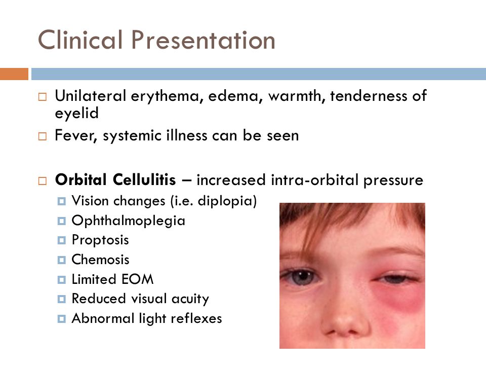 5 Clinical Presentation