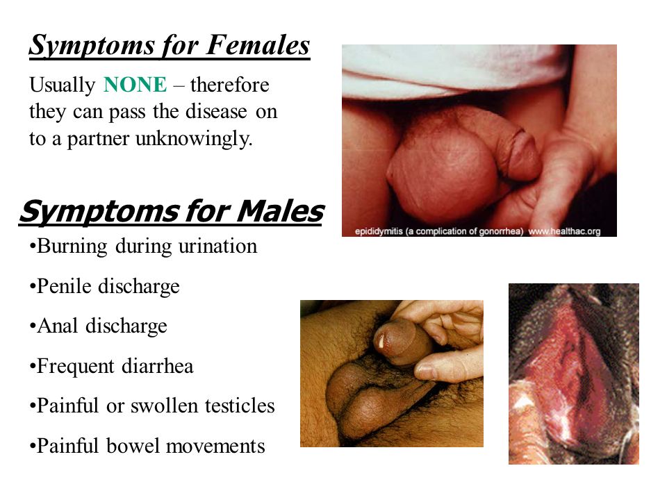 Gay Men And Shingellosis