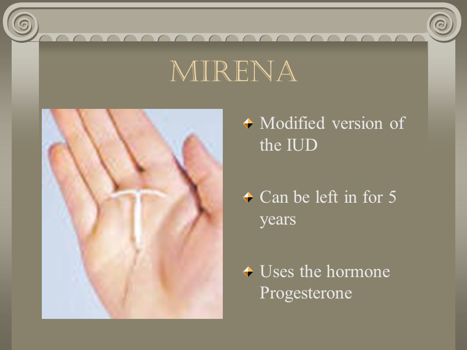 mirena Modified version of the IUD Can be left in for 5 years