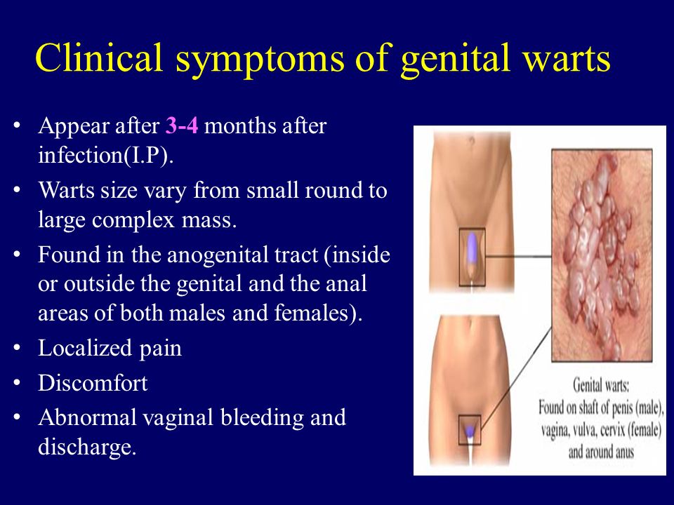 Hpv warts discharge