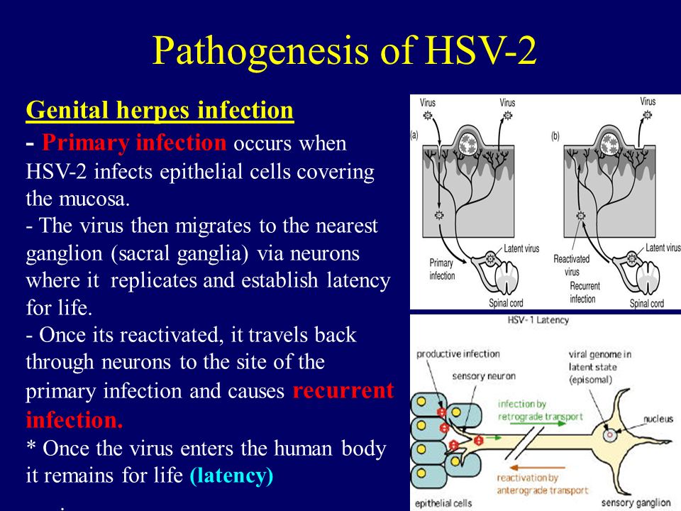 Condilom neglijat, Condiloamele acuminate: o patologie neglijată - Hpv vs herpes warts