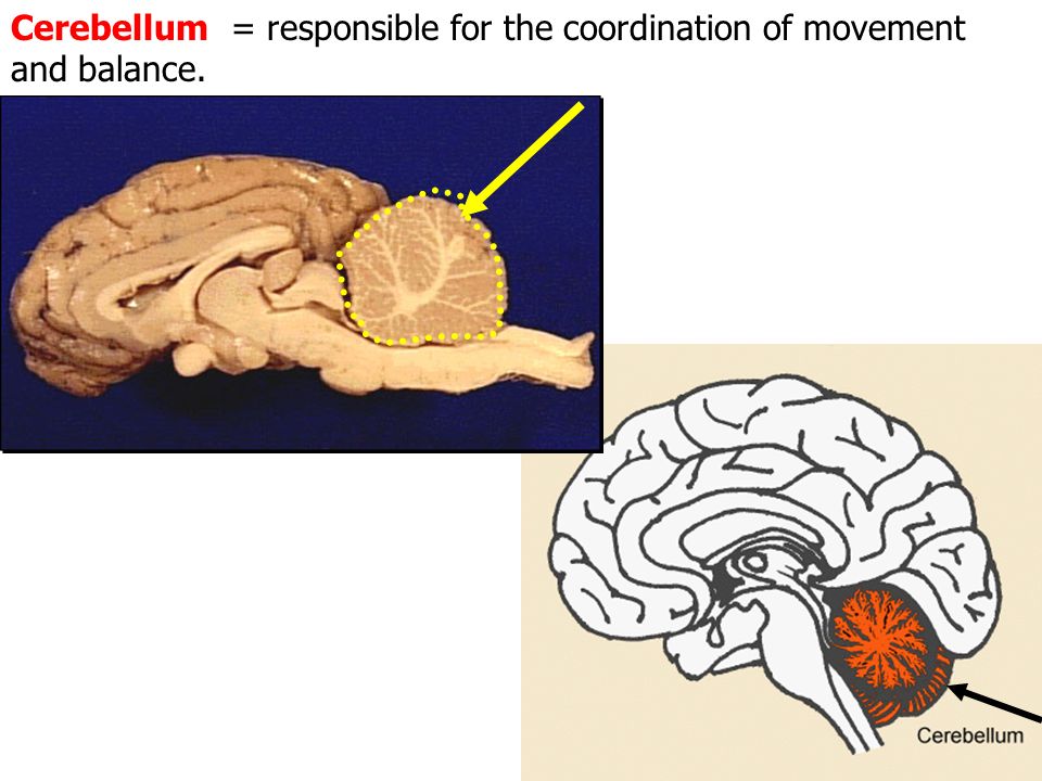 Тест по теме мозг 8 класс. Cerebellum. Cerebellum gif. Кто любит церебелу из skilsi. Venous Malformation of the cerebellum MRI.