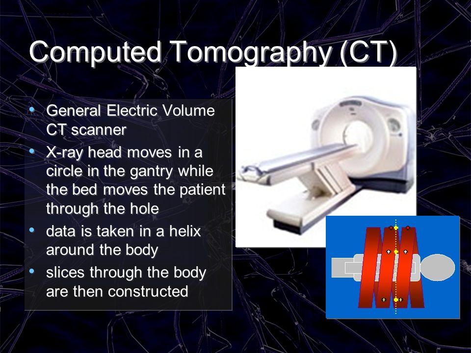 Computed Tomography (CT)
