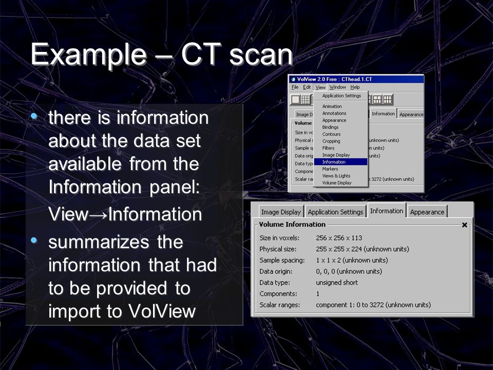 Example – CT scan there is information about the data set available from the Information panel: View→Information.