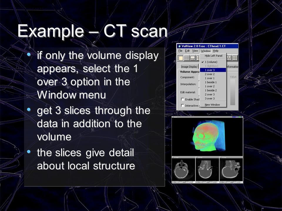Example – CT scan if only the volume display appears, select the 1 over 3 option in the Window menu.