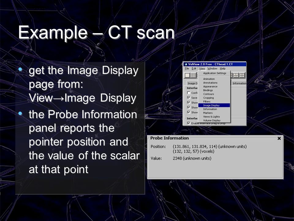 Example – CT scan get the Image Display page from: View→Image Display