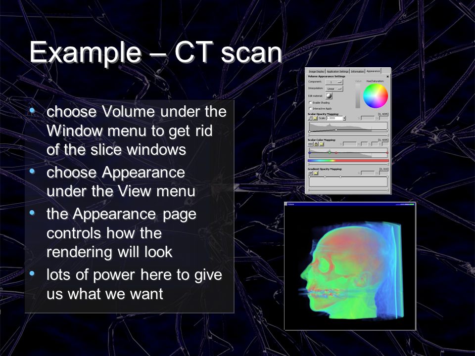 Example – CT scan choose Volume under the Window menu to get rid of the slice windows. choose Appearance under the View menu.