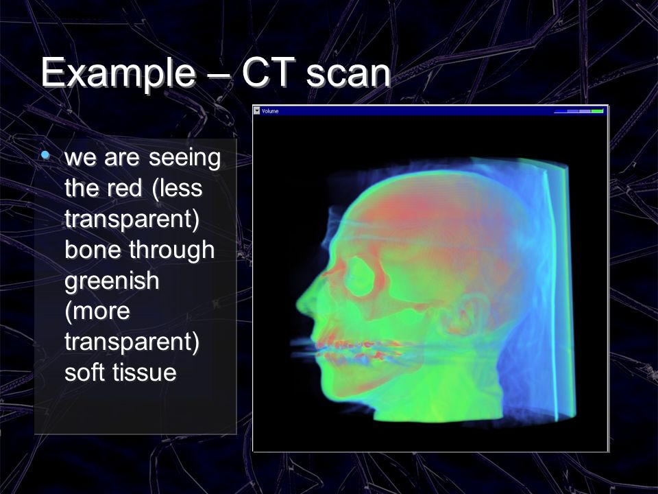 Example – CT scan we are seeing the red (less transparent) bone through greenish (more transparent) soft tissue.