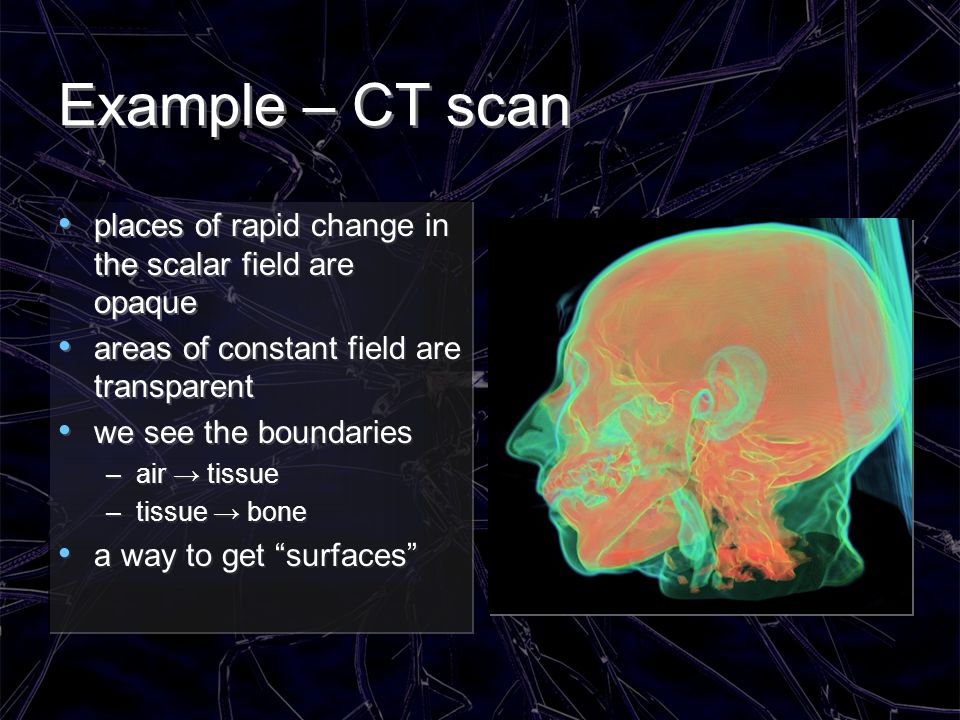 Example – CT scan places of rapid change in the scalar field are opaque. areas of constant field are transparent.