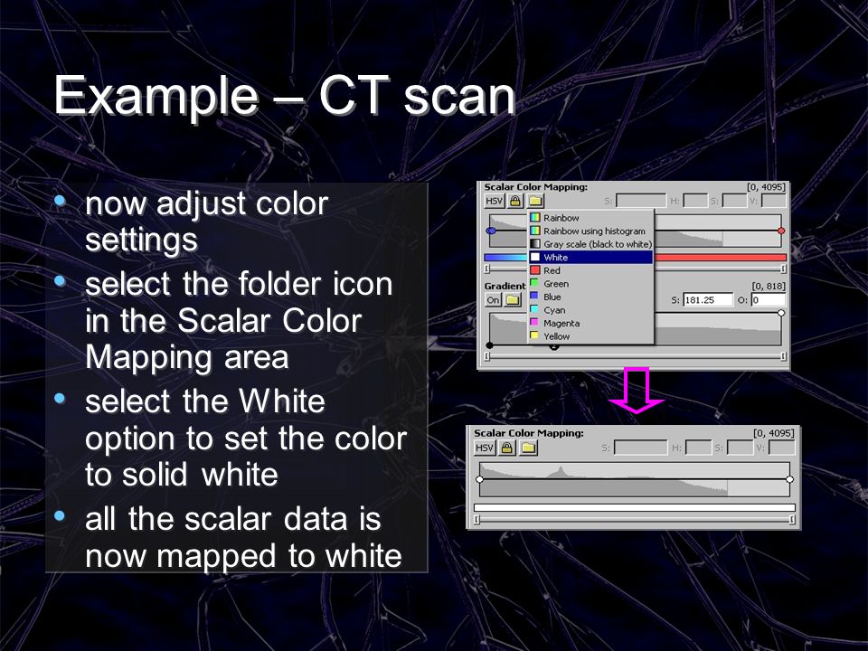 Example – CT scan now adjust color settings