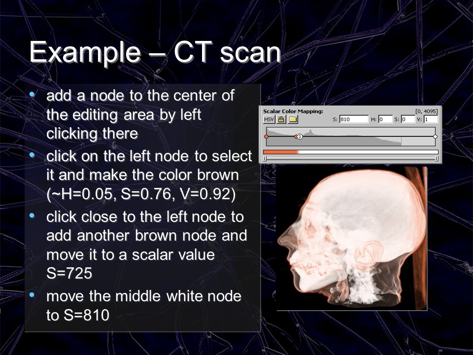 Example – CT scan add a node to the center of the editing area by left clicking there.