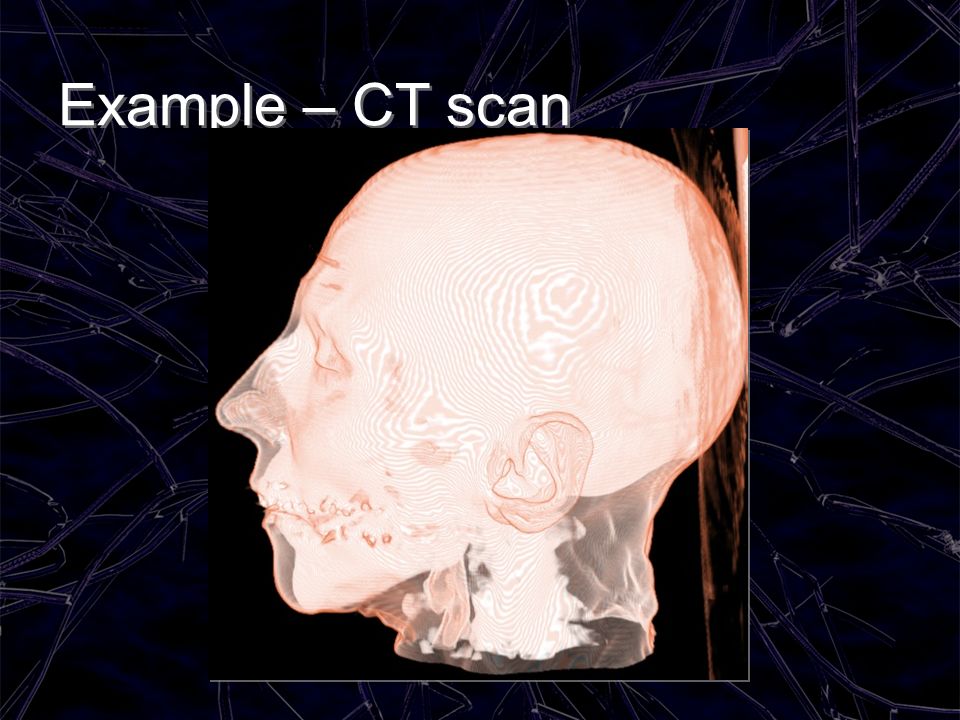 Example – CT scan