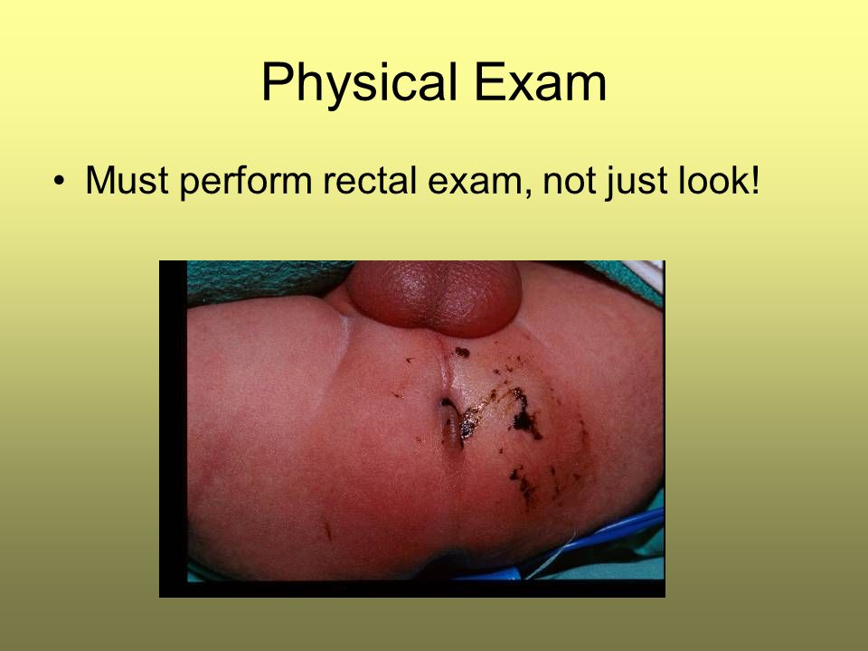 Physical Exam Must perform rectal exam, not just look!