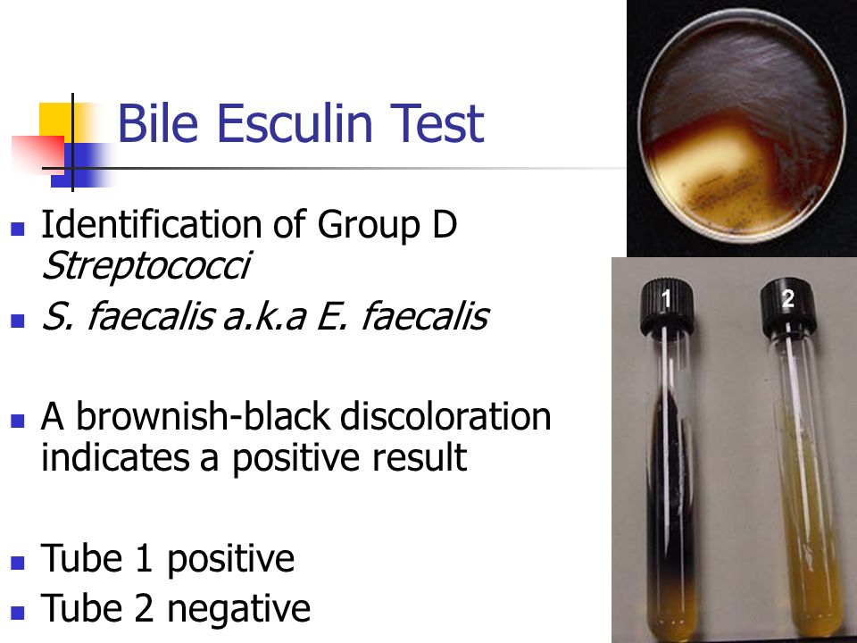 Bile+Esculin+Test+Identification+of+Group+D+Streptococci.jpg