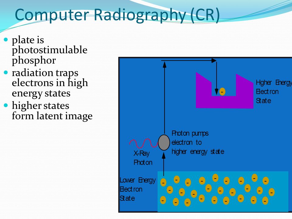 Computer Radiography (CR)