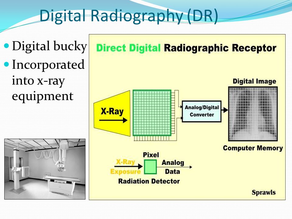 Digital Radiography (DR)