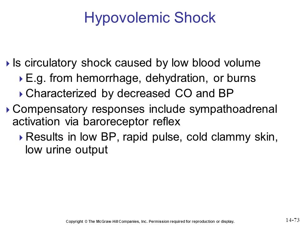 Hypovolemic Shock Is circulatory shock caused by low blood volume