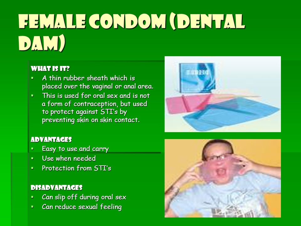 Female Condom (Dental Dam) .