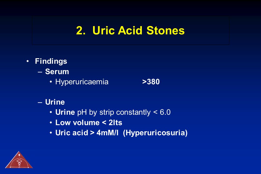 2. Uric Acid Stones Findings Serum Hyperuricaemia >380 Urine