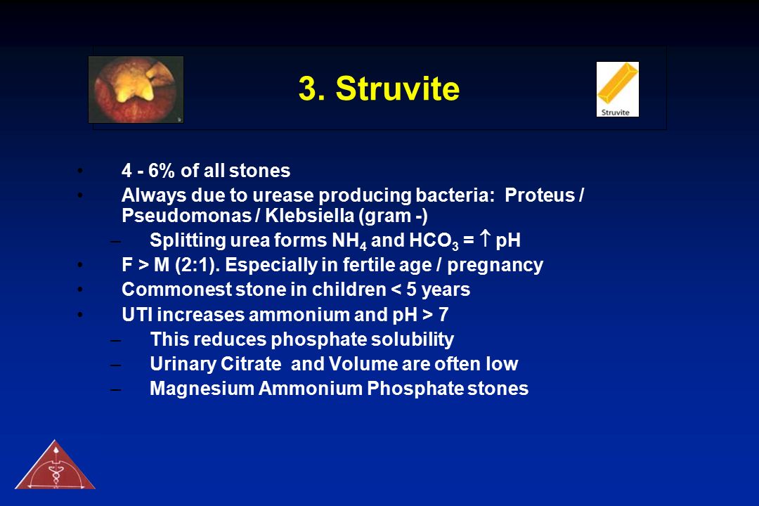 3. Struvite 4 - 6% of all stones