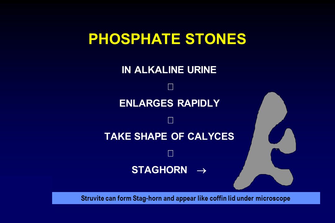 PHOSPHATE STONES IN ALKALINE URINE ¯ ENLARGES RAPIDLY ¯ TAKE SHAPE OF CALYCES ¯ STAGHORN ®