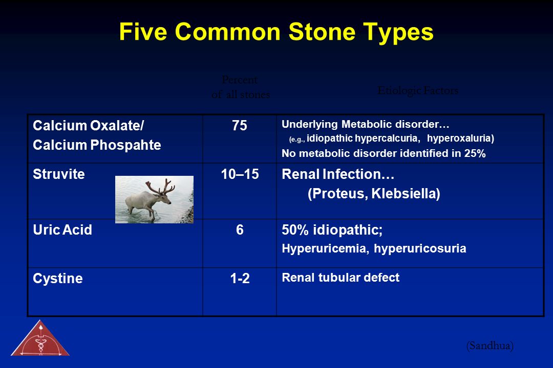 Five Common Stone Types