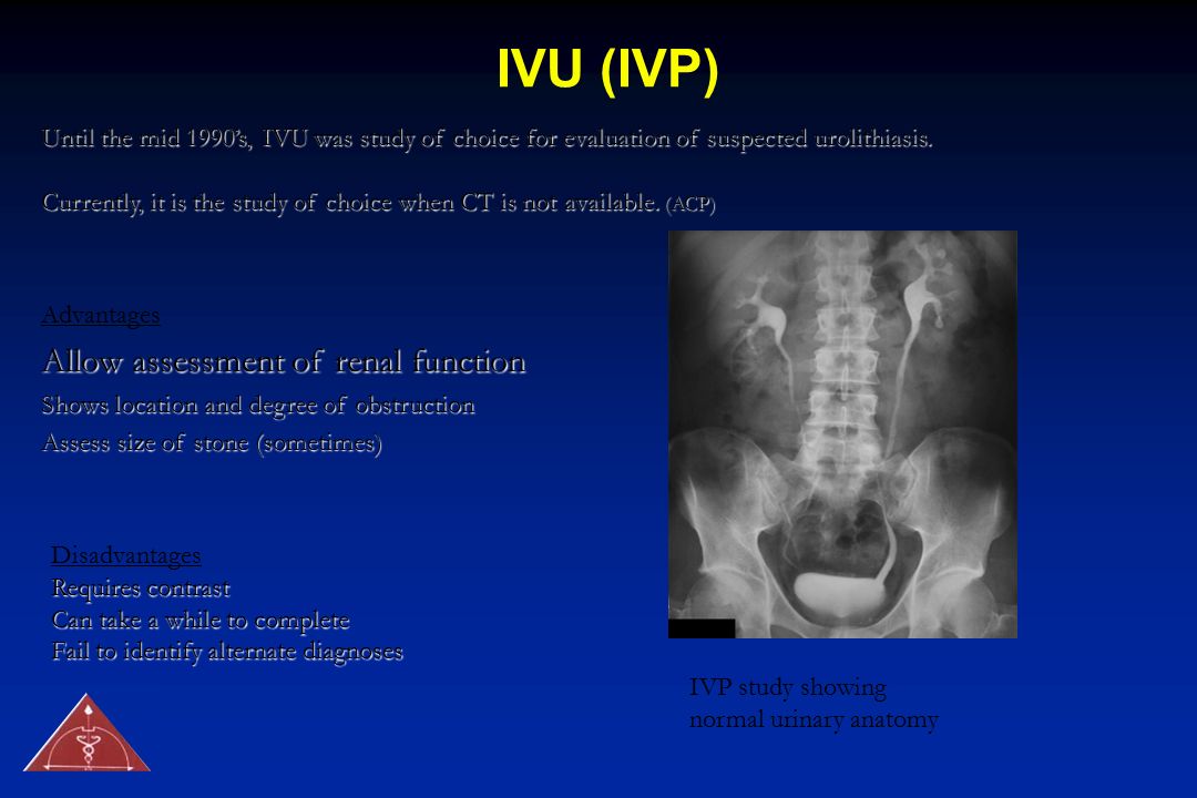 IVU (IVP) Allow assessment of renal function