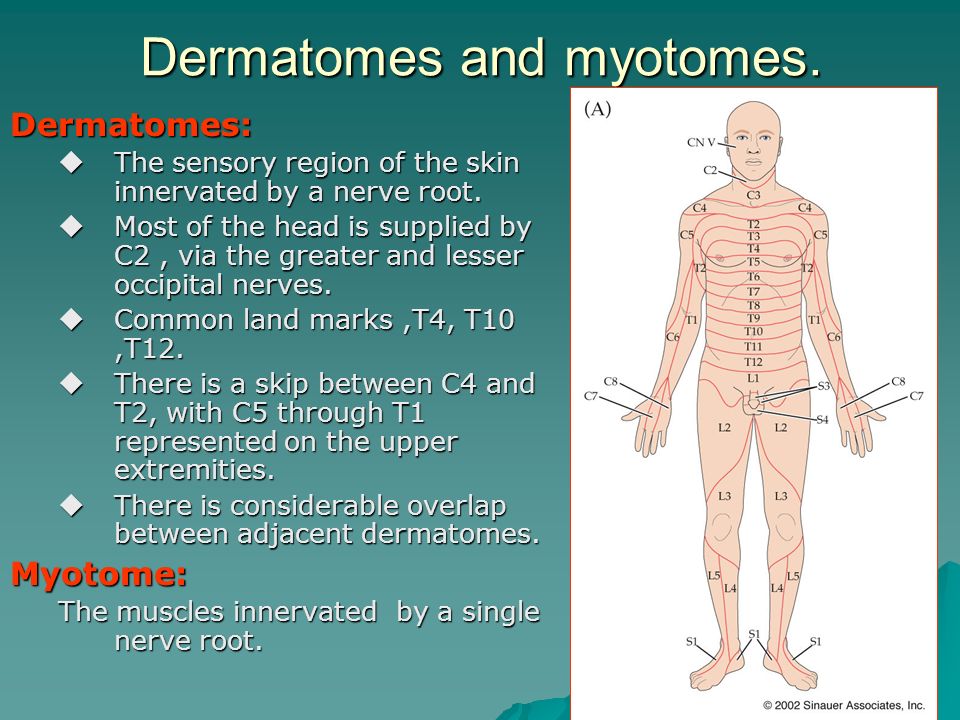 Chapter 8 Spinal Nerve Roots Ppt Video Online Download Chapter 8 Spinal Nerve Roots Ppt Video Online Download