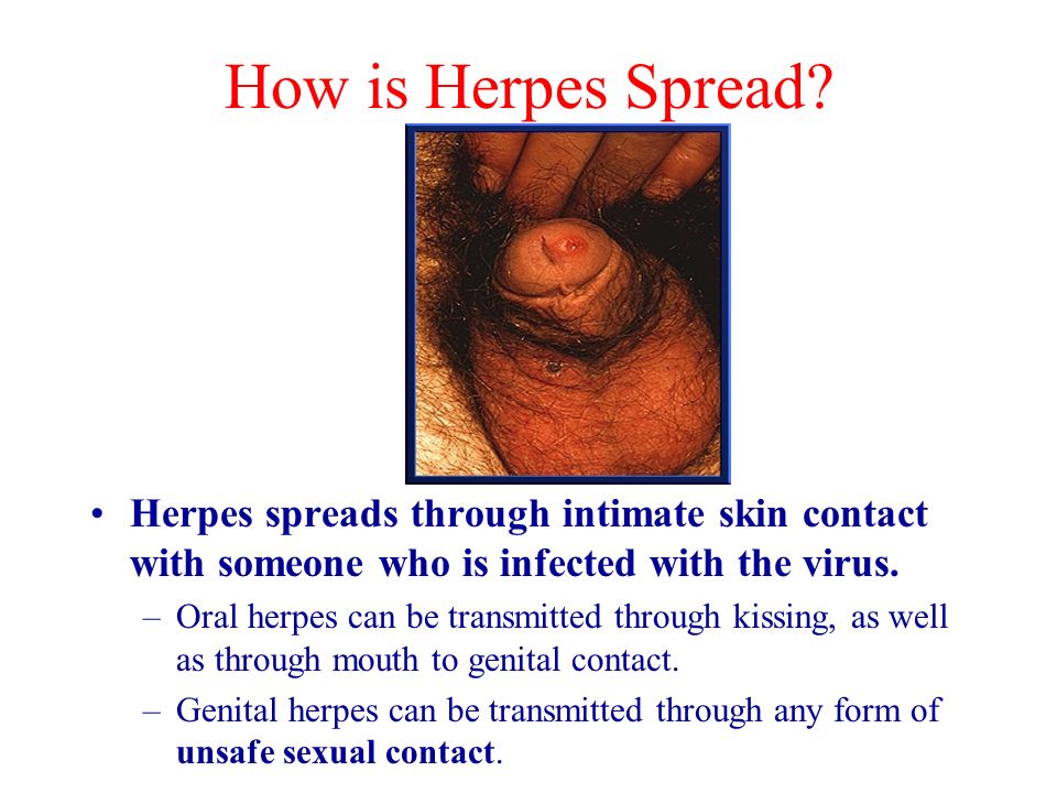 Sexually Transmitted Diseases Ppt Video Online Download