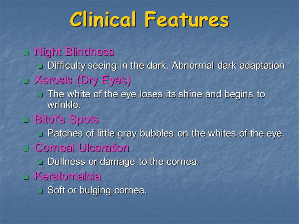 Xerophthalmia Literaly Means Dry Eye Ppt Video Online Download