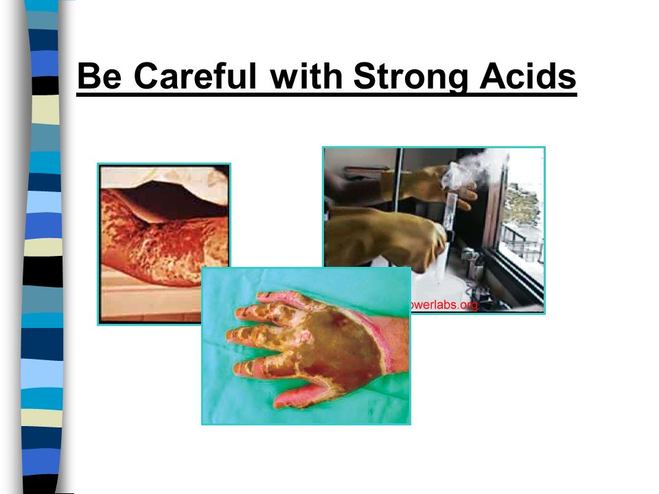 Be Careful with Strong Acids