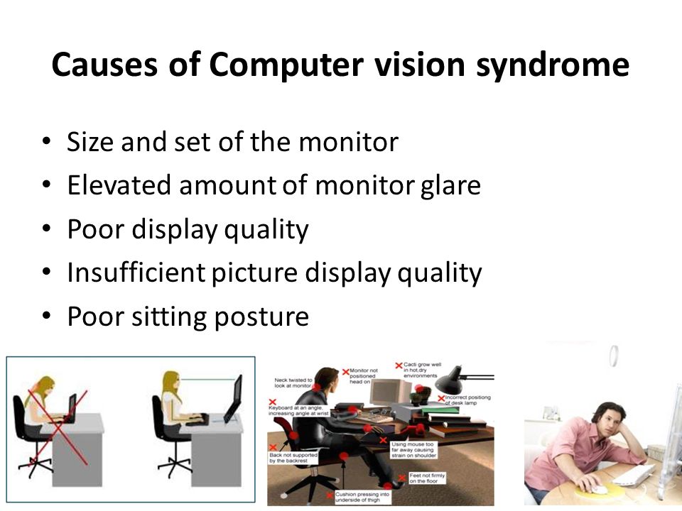 Causes of Computer vision syndrome