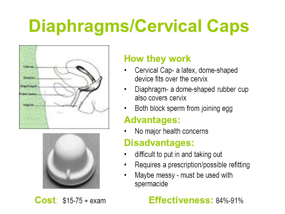 Diaphragms/Cervical Caps