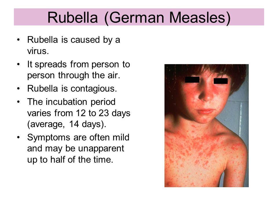 vaccine preventable diseases ppt download