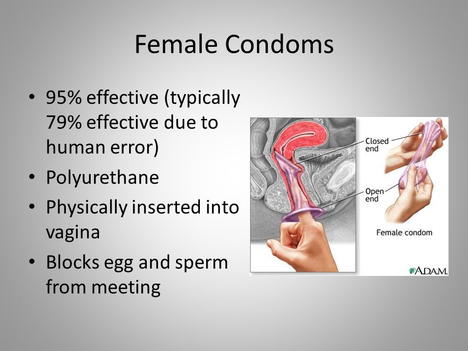 Female Condoms 95% effective (typically 79% effective due to human error) Polyurethane. Physically inserted into vagina.