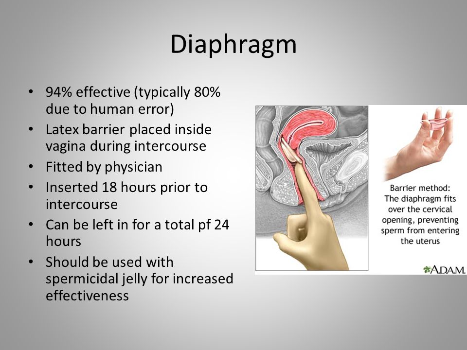 Diaphragm 94% effective (typically 80% due to human error)