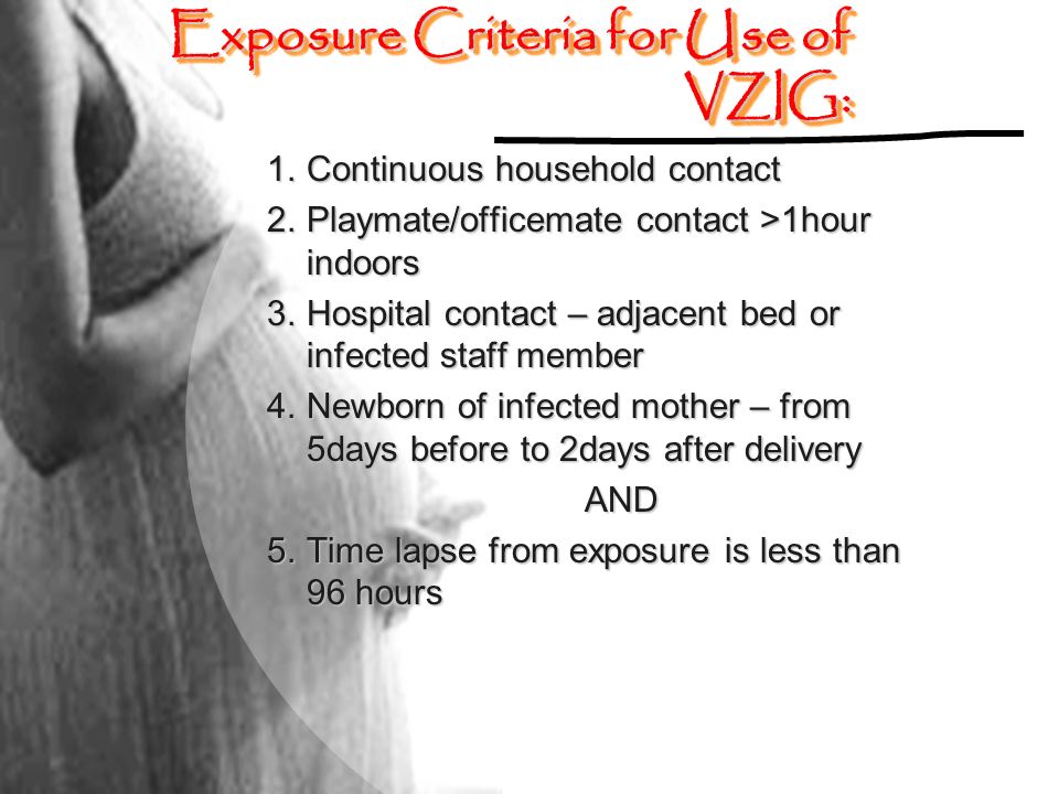 Exposure Criteria for Use of VZIG: