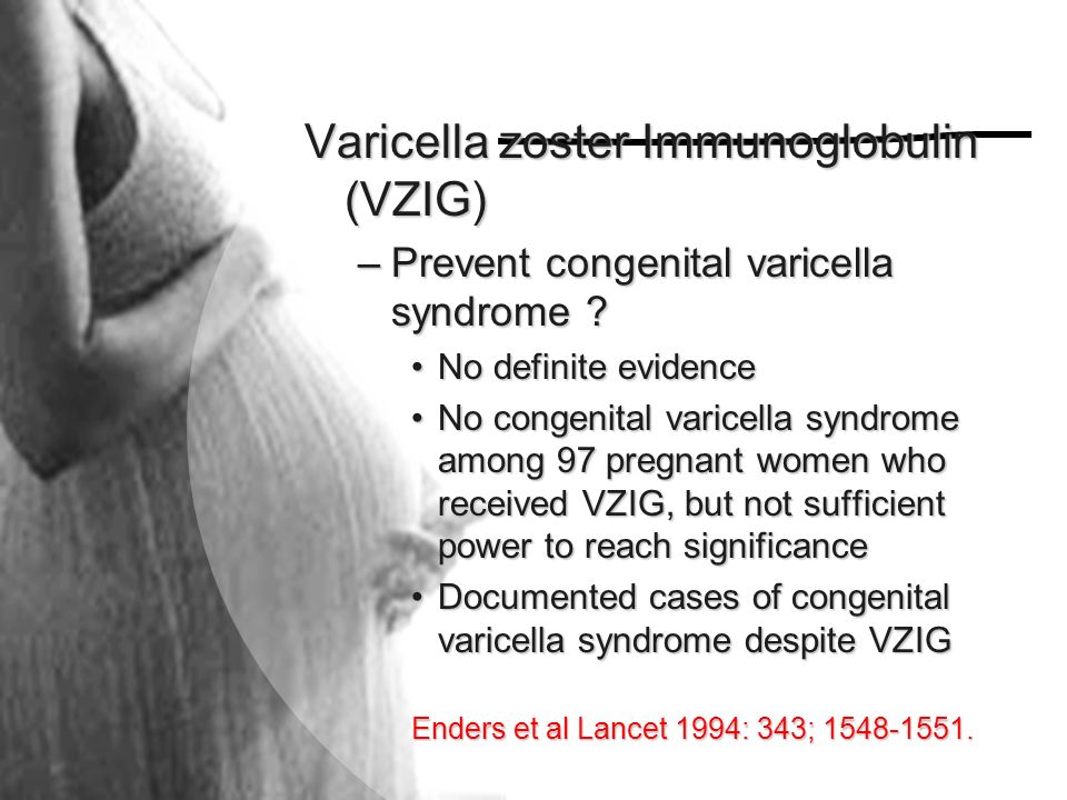 Varicella zoster Immunoglobulin (VZIG)