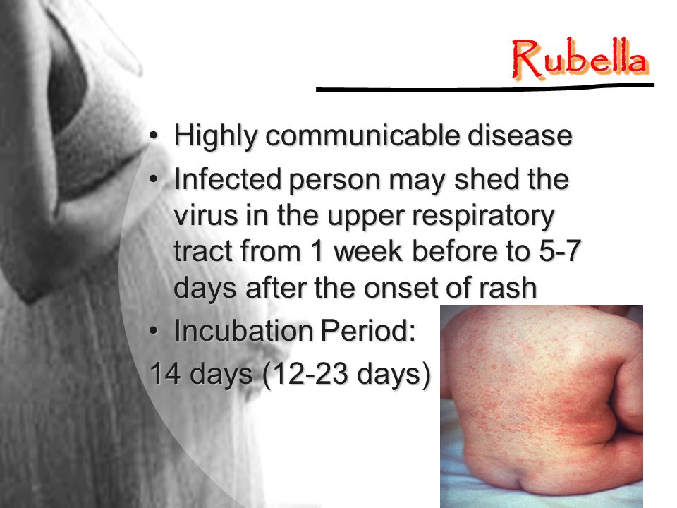 Rubella Highly communicable disease