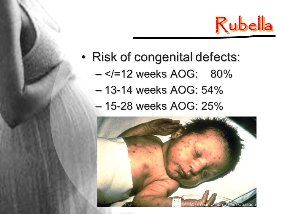 Rubella Risk of congenital defects: </=12 weeks AOG: 80%
