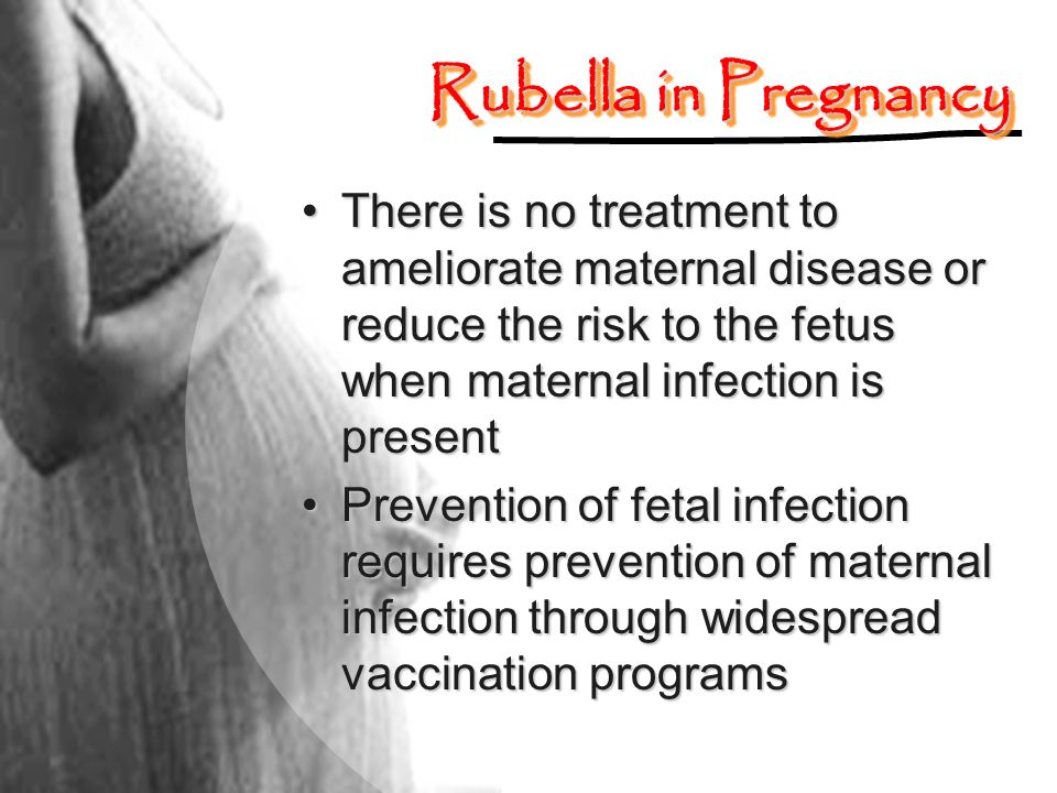 Rubella in Pregnancy There is no treatment to ameliorate maternal disease or reduce the risk to the fetus when maternal infection is present.