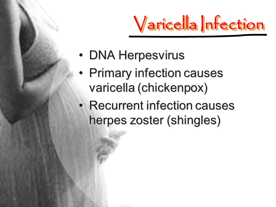 Varicella Infection DNA Herpesvirus